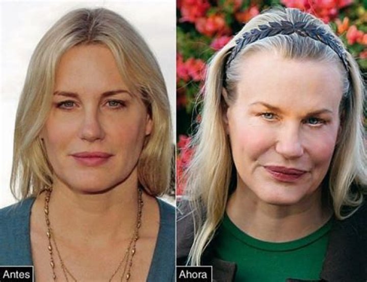 Daryl Hannah Plastic Surgery Before and After