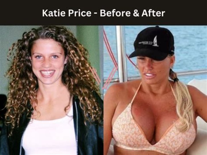 Diane Lane Breast Implants Plastic Surgery Before and After