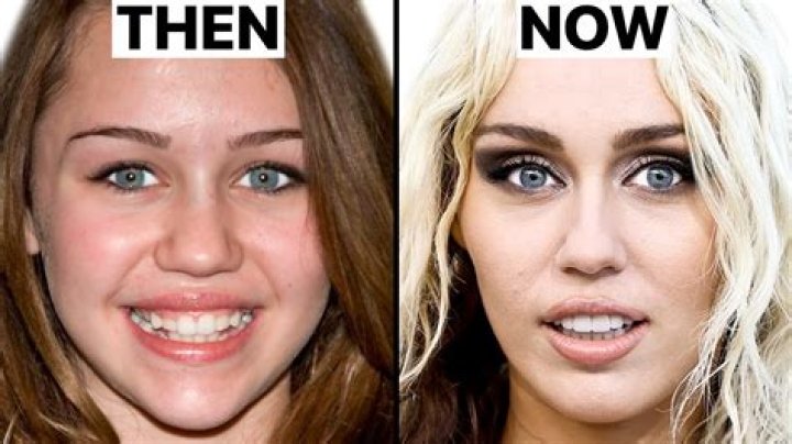 Did She Have Plastic Surgery? What happened to her?