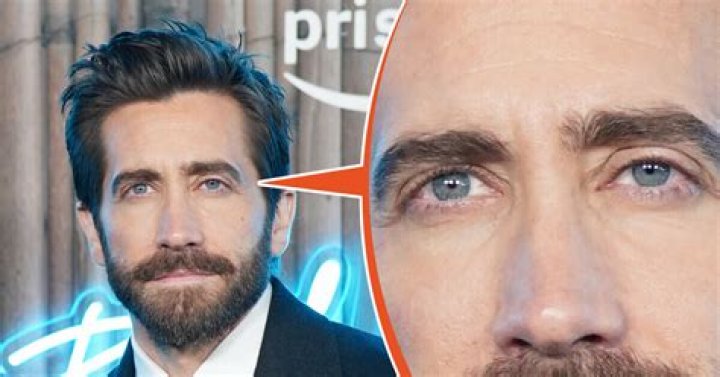 Does Jake Gyllenhaal have an eye problem? – Celebrity