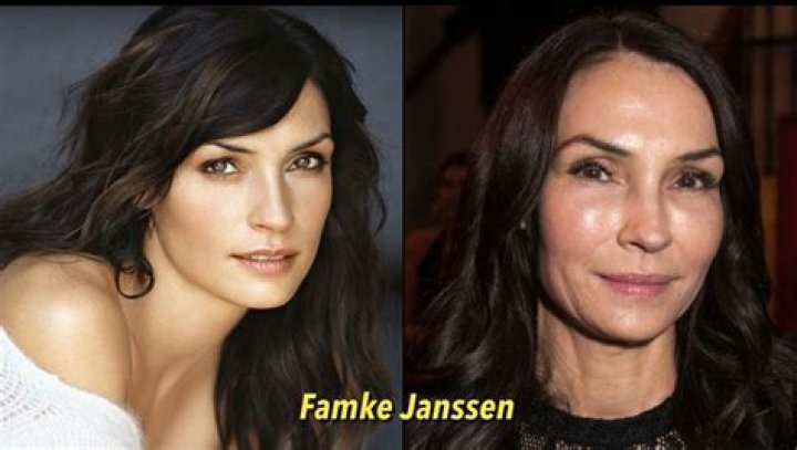 Famke Janssen Plastic Surgery Before and After