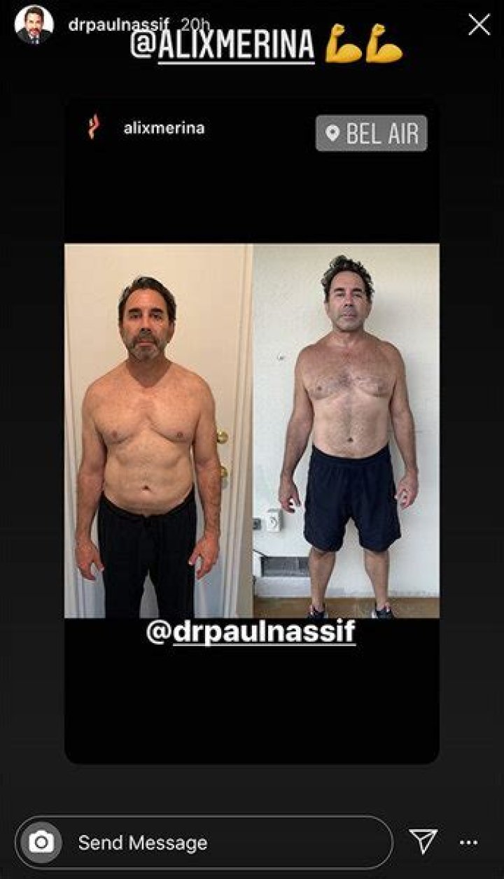 How Did Dr Paul Nassif Lose Weight?