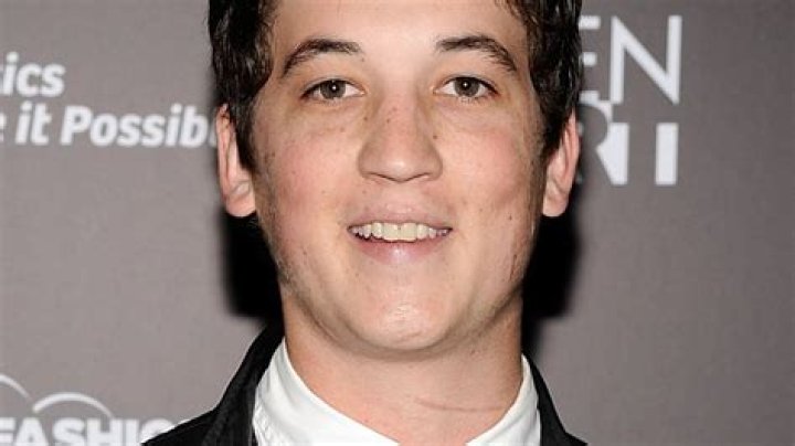 How did Miles Teller get his scars?