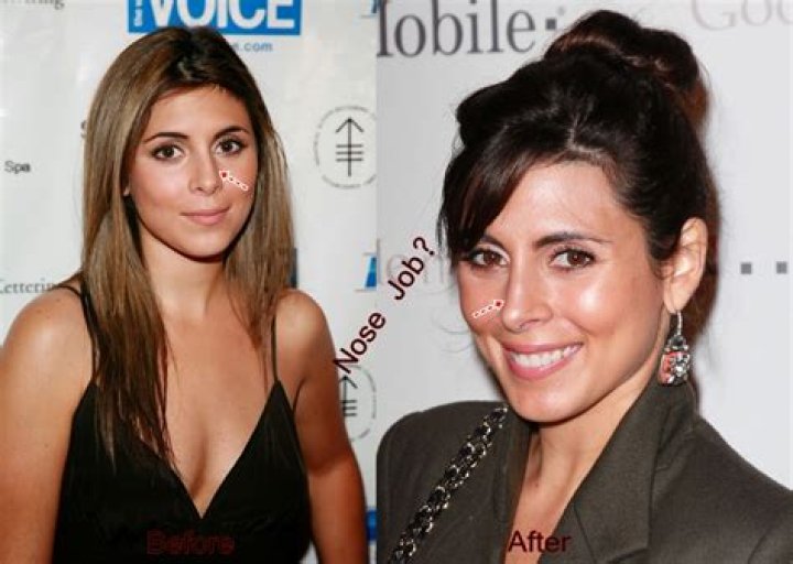 Jamie-Lynn Sigler Plastic Surgery Before and After