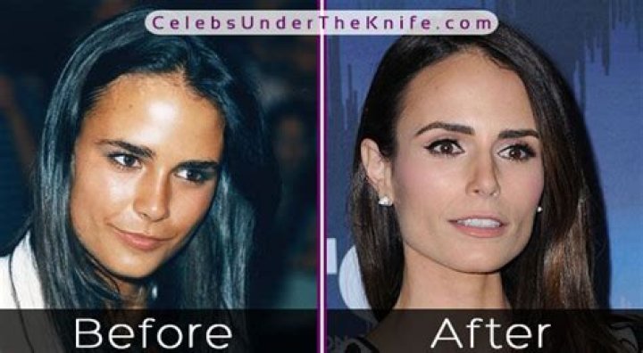 Jordana Brewster Plastic Surgery Before and After