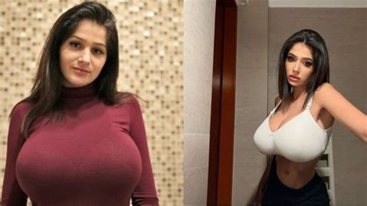 Julia Tica plastic surgery before and after photo