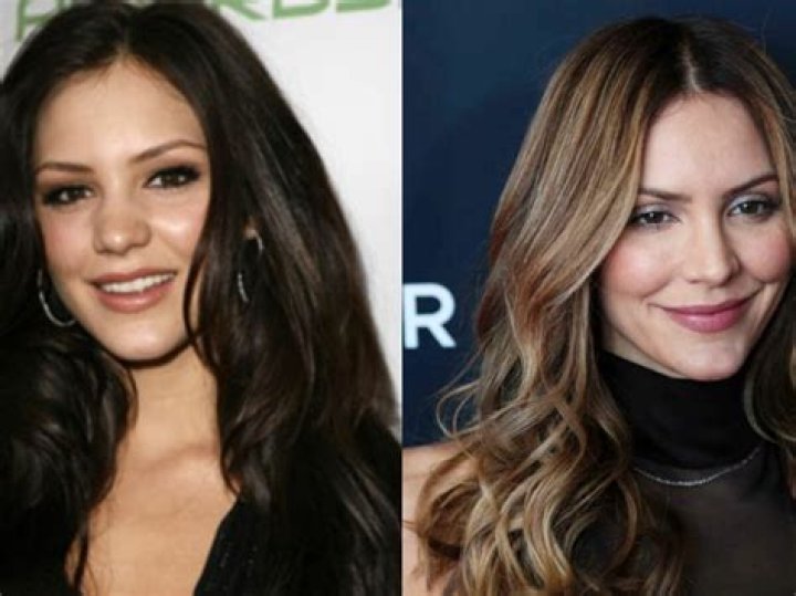 Katharine McPhee Plastic Surgery Before and After