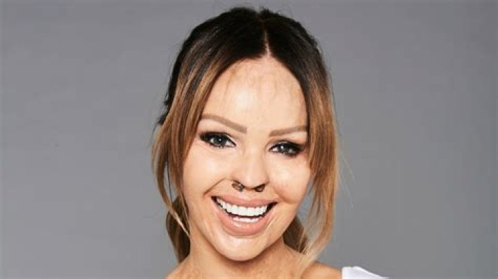 Katie Piper Biography - Facts, Childhood, Family Life & Achievements