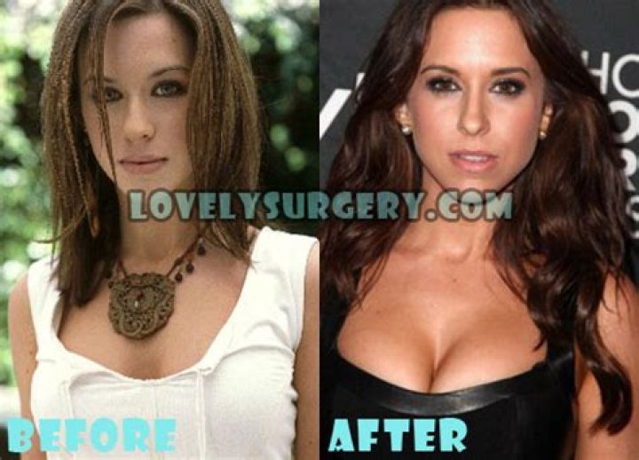 Lacey Chabert Plastic Surgery Before and After