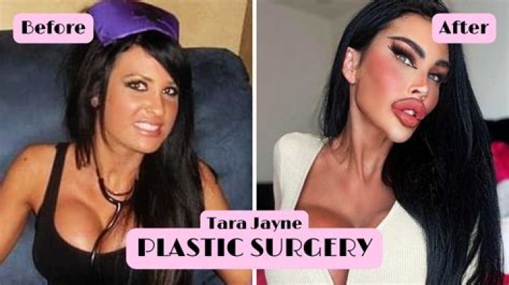 Pictures of Tara Jayne Before Surgery