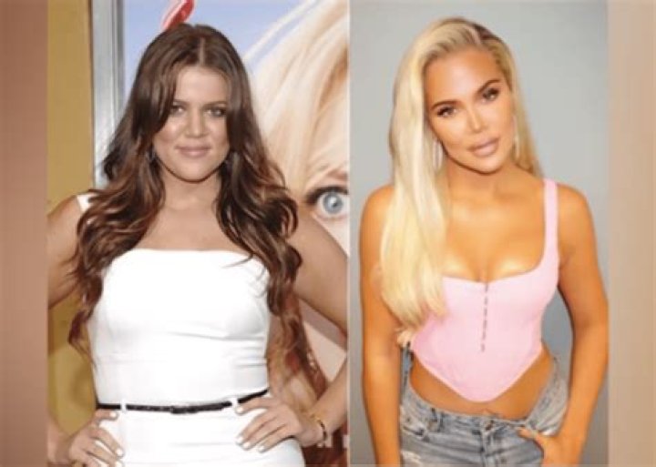 Plastic Surgeon Weighs In On Khloe Kardashian’s Before And After Photos— Talks Procedures She May Have Had