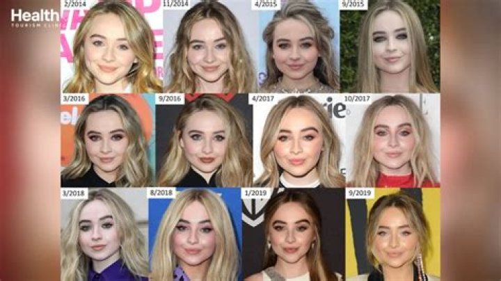 Sabrina Carpenter Plastic Surgery: Breast Augmentations, Lip Fillers, or Glowing Naturally?