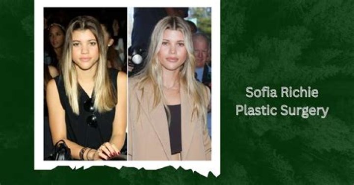 Sofia Richie Plastic Surgery: A Close Examination of Her Nose Job and Lip Filler Choices