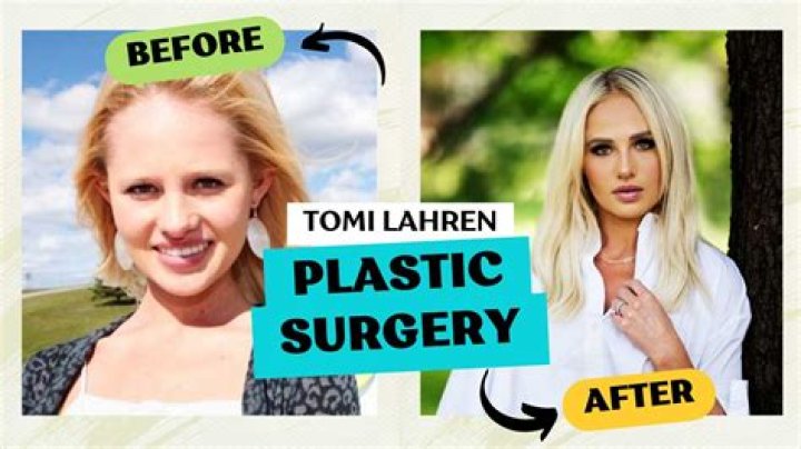 Tomi Lahren Plastic Surgery: Did She Undergo Plastic Surgery?