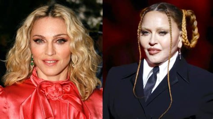 What did Madonna do to her face? Her before and after photo, explained