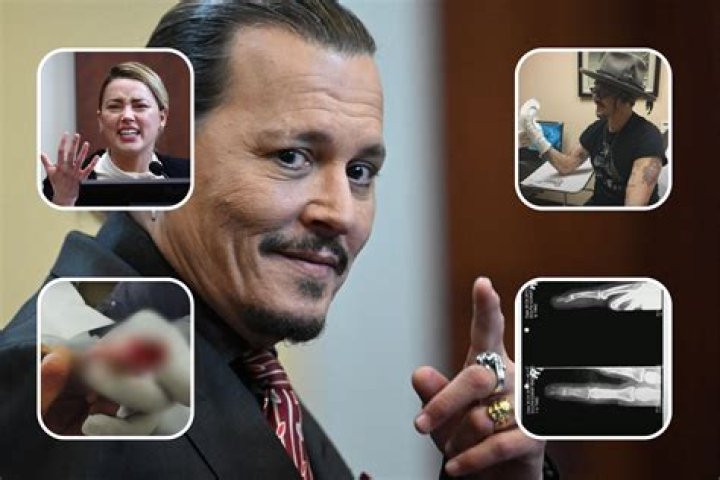 What happened to Johnny Depp's finger? How did Johnny Depp lose his finger?