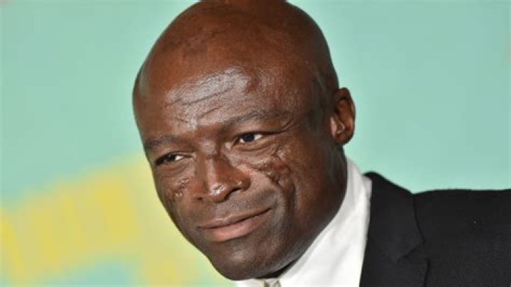What happened to Seal’s face? His facial scars explained
